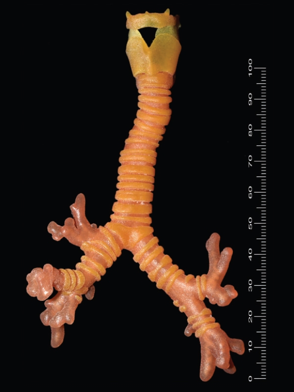 3D printed paediatric trachea.