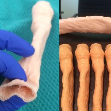 Multiple variations of flexible 3D printed tracheas.